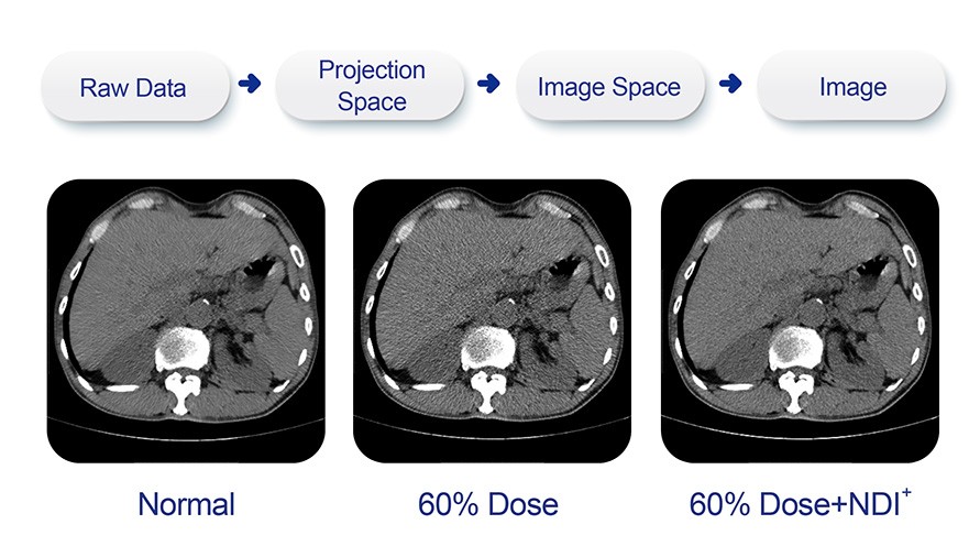 Efficient Dose Management