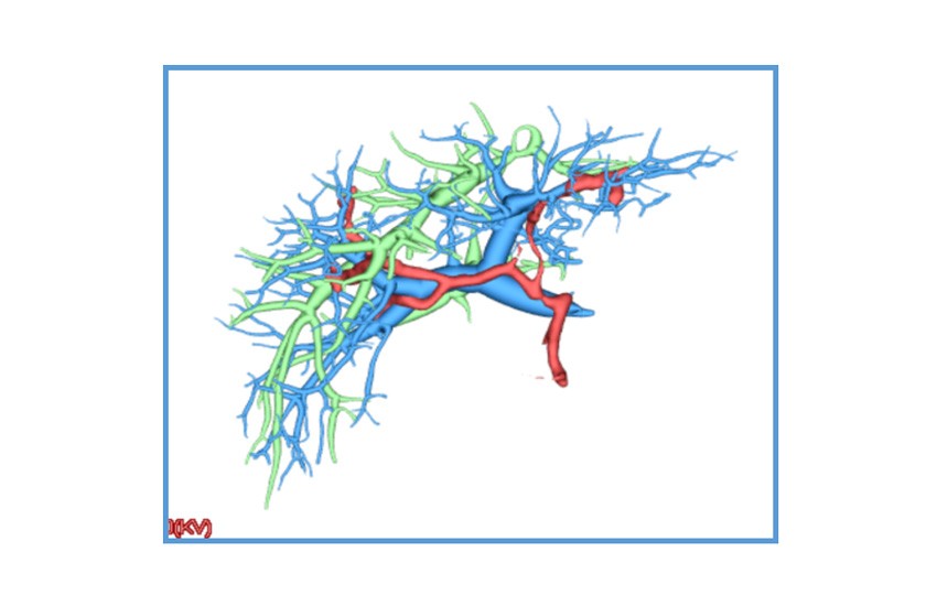 Case 1-3<br>Vessels Segmentation