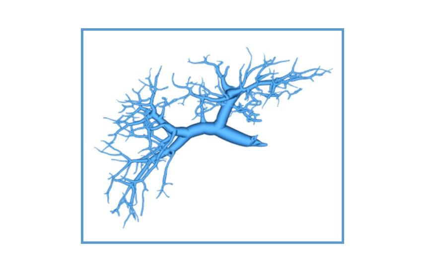 Case 1-6<br>Hepatic Portal Vein