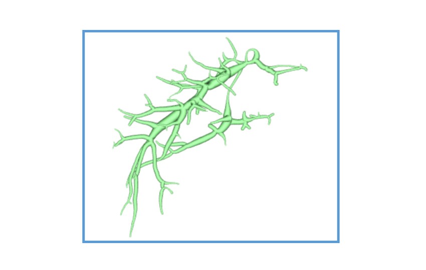 Case 1-5<br>Hepatic Vein