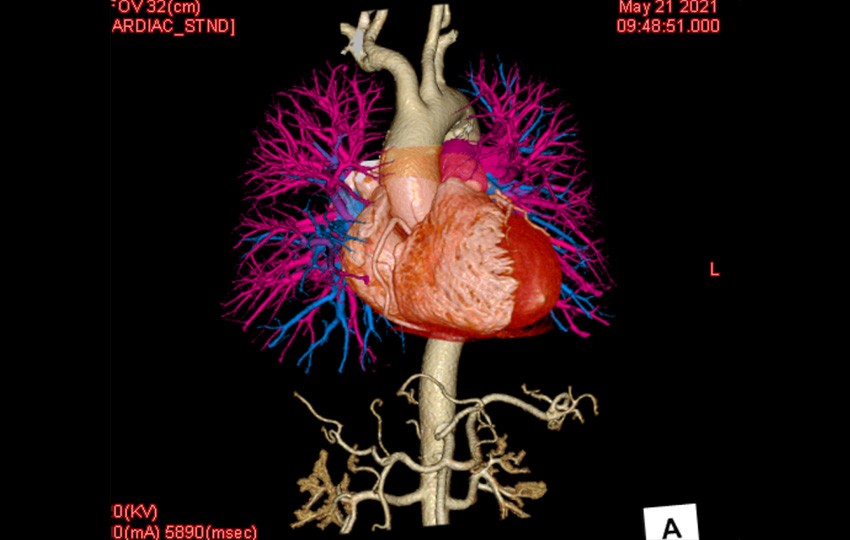 Case 1-1<br>Triple-Rule-Out