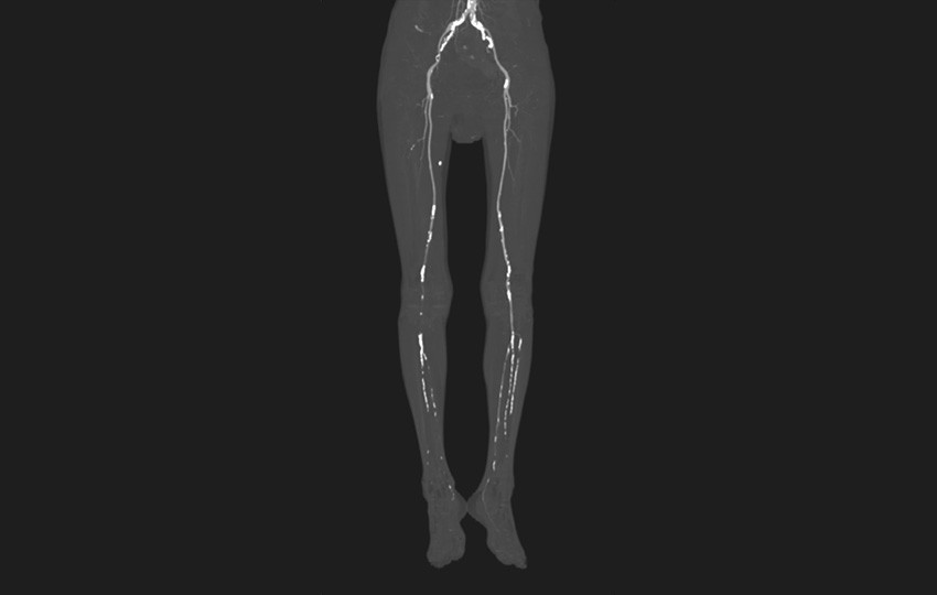 Case 1-3
