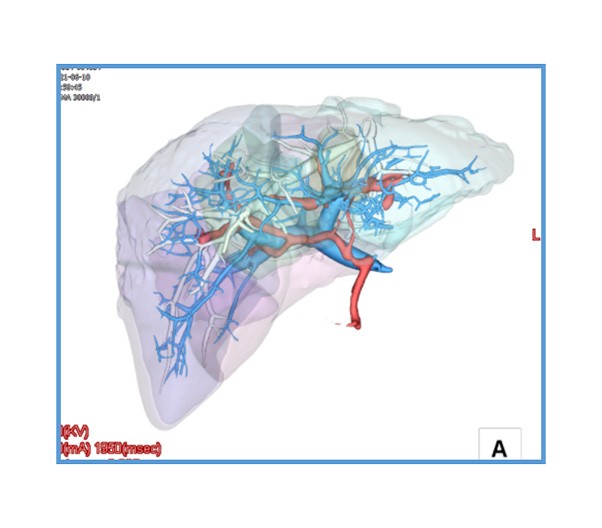 Liver Analysis