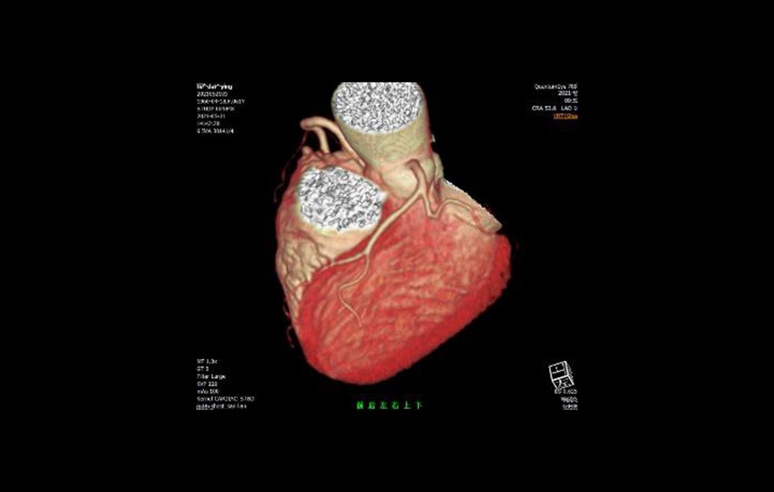 Case 1-3<br>Coronary Artery