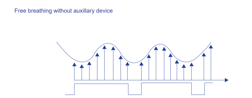 Digital Gating Technology